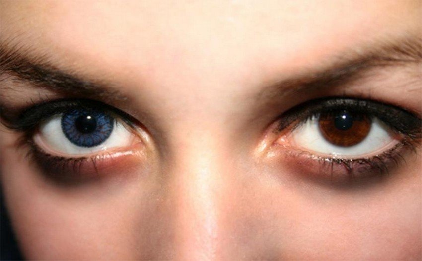 Другой голубой. Гетерохромия глаз голубой и Карий. Цветные линзы гетерохромия. Гетерохромия с красным глазом. Голубые линзы гетерохромия.