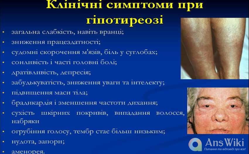 Підвищені АТПО. Що робити?